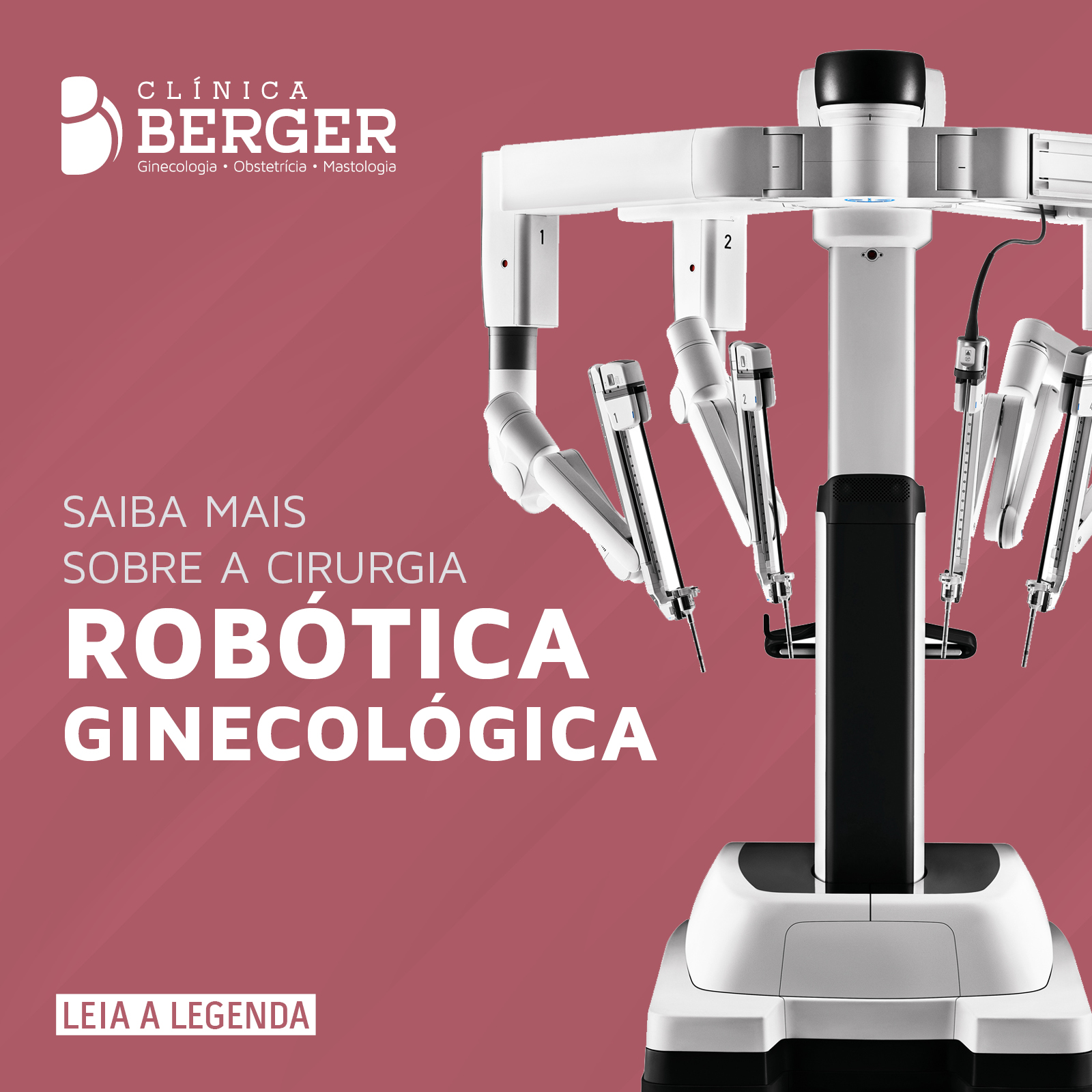 Saiba mais sobre a cirurgia robótica ginecológica