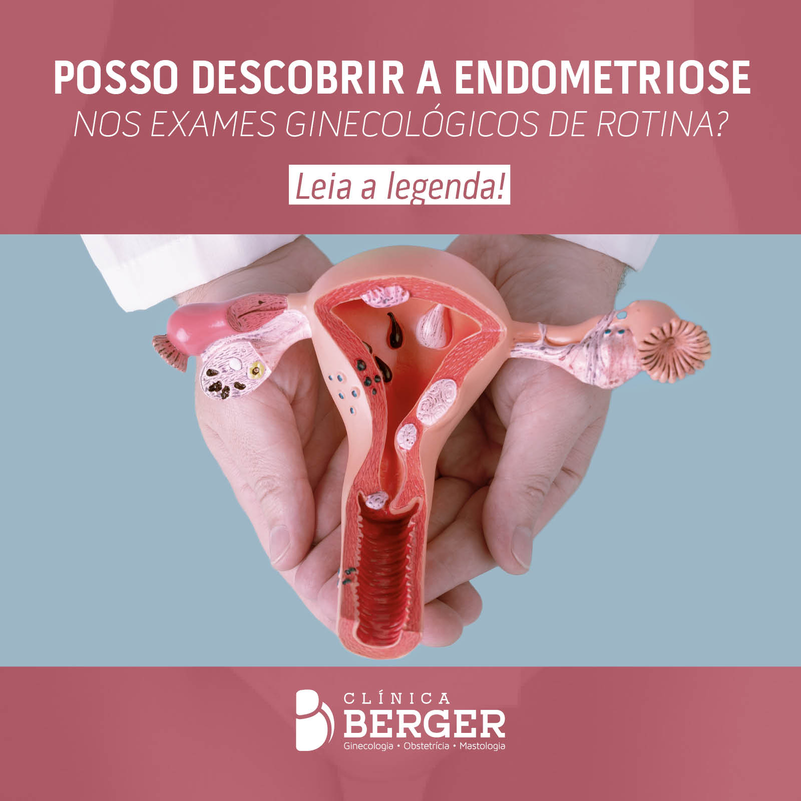Posso descobrir a endometriose nos exames ginecológicos de rotina?