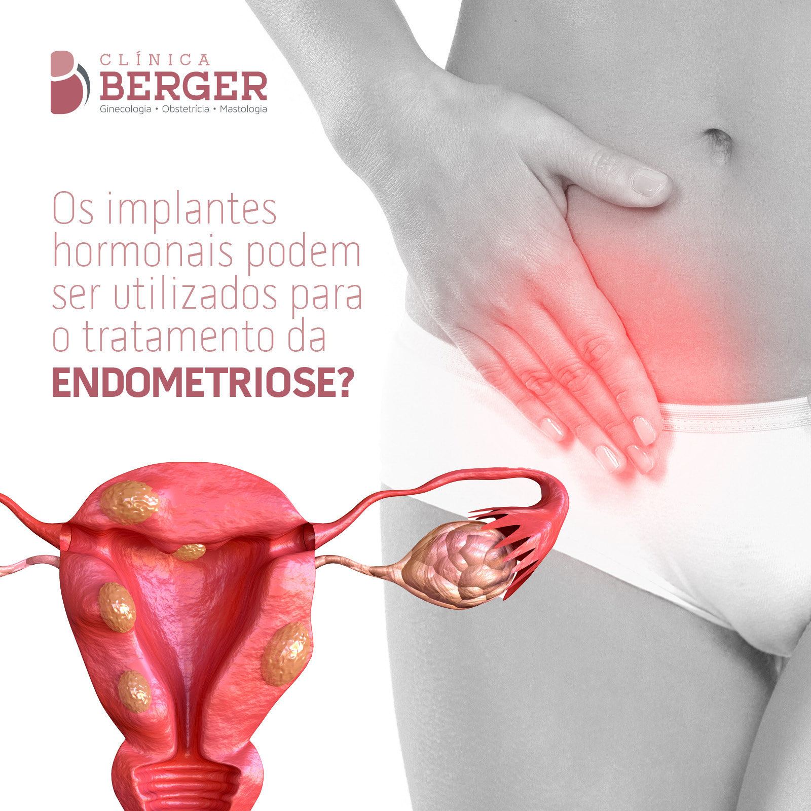 Os implantes hormonais podem ser utilizados para o tratamento da endometriose?